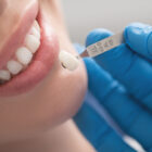 Sigara için kişilerde dental implantların başarısı