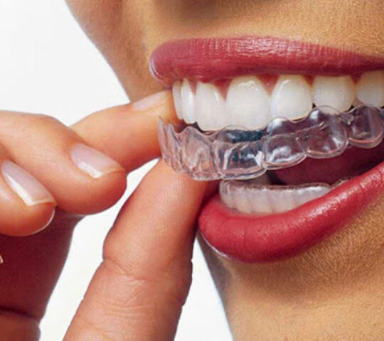 Bursa Ortodonti 2 Ağız ve Diş Sağlığı Polikliniği
