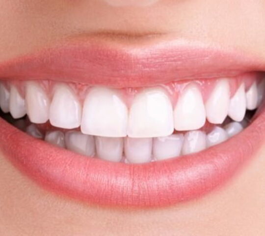 Bursa Ortodonti Ağız ve Diş Sağlığı Polikliniği